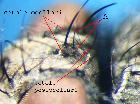 campylocheta inepta_setole ocellari