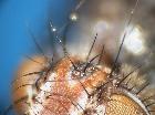 germaria ruficeps_setole ocellari