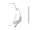 zeuxia brevicornis_complesso epandriale laterale scala 1mm